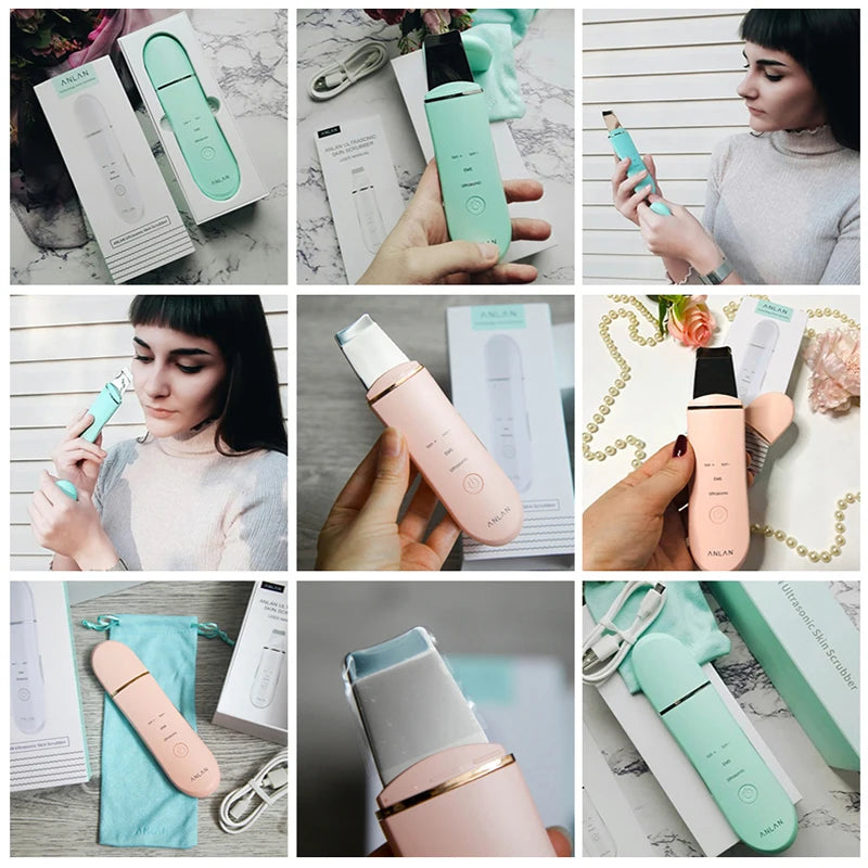 ANLAN Ultrasonic Skin Scrubber – Deep Pore Cleansing & Gentle Facial Exfoliation Tool