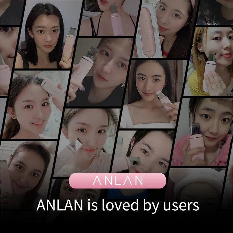 ANLAN Ultrasonic Skin Scrubber – Deep Pore Cleansing & Gentle Facial Exfoliation Tool