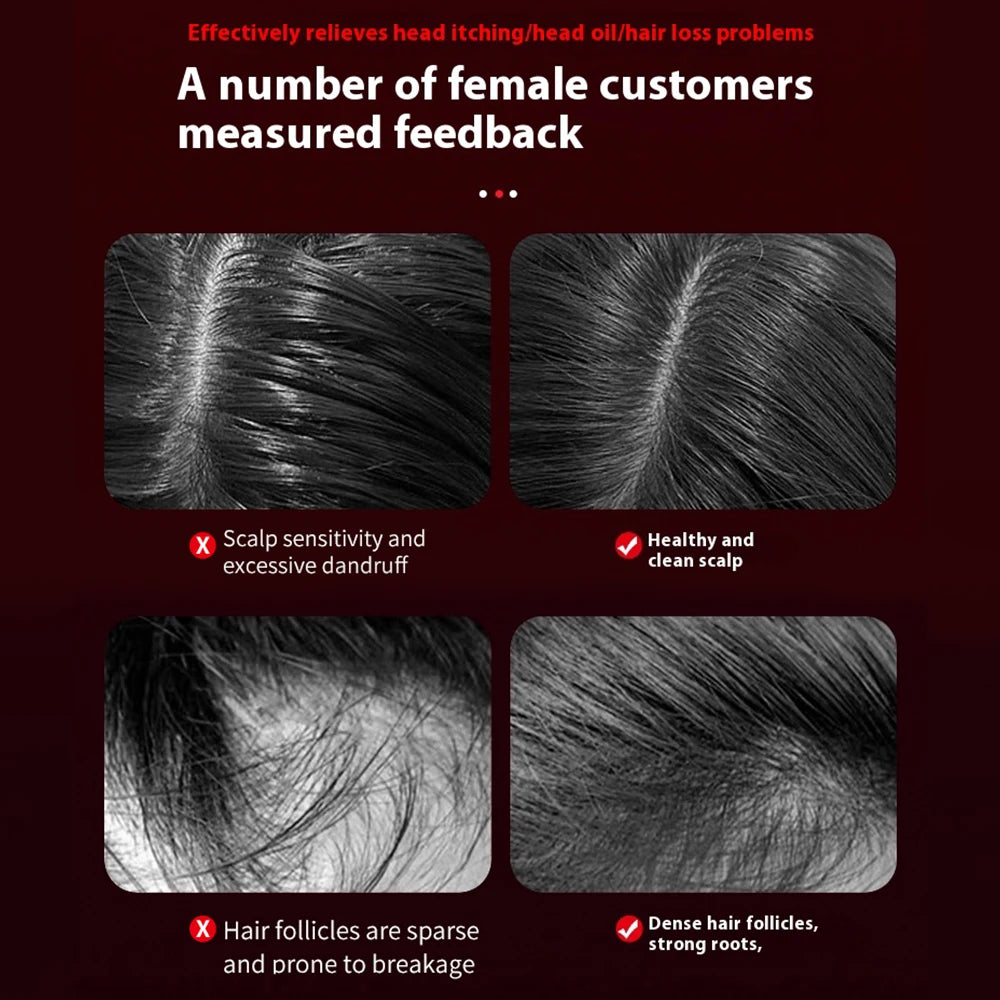 Red Light Microcurrent Scalp Massage Comb – Rechargeable Hair & Scalp Care Tool