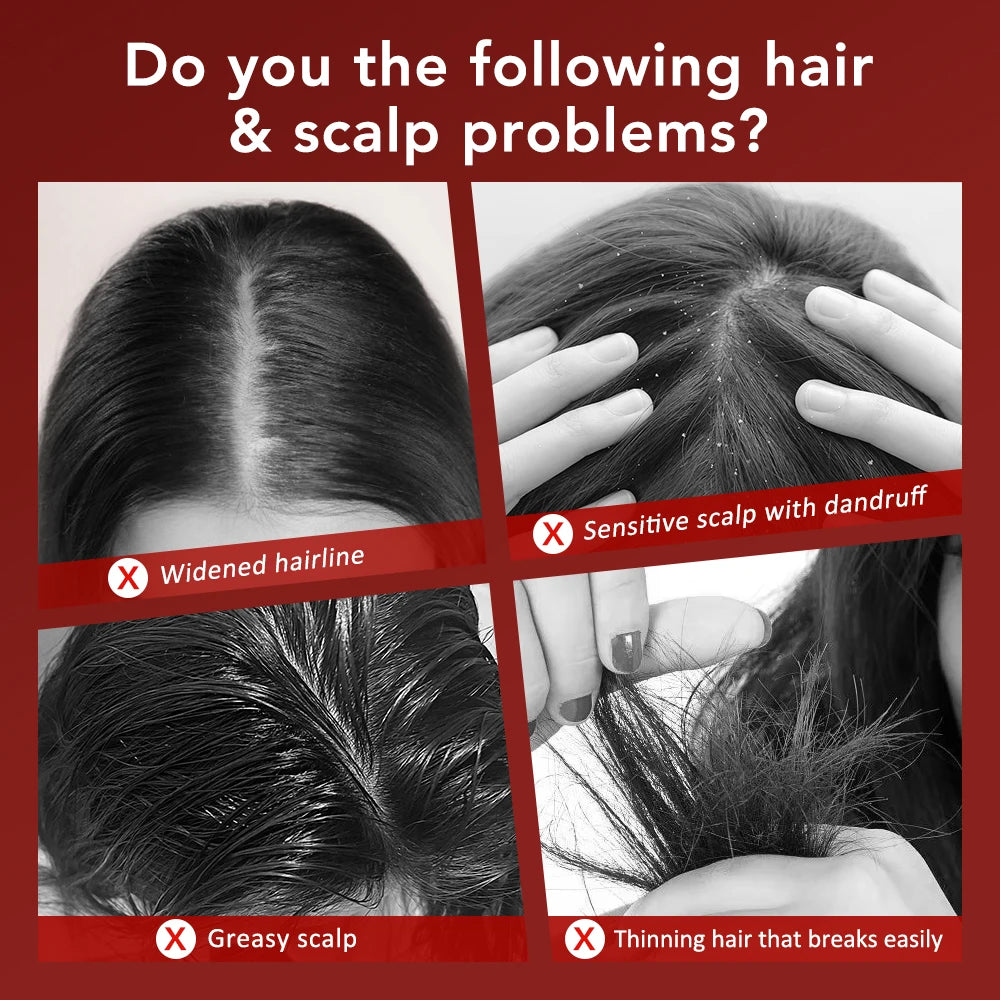 Red Light Microcurrent Scalp Massage Comb – Rechargeable Hair & Scalp Care Tool